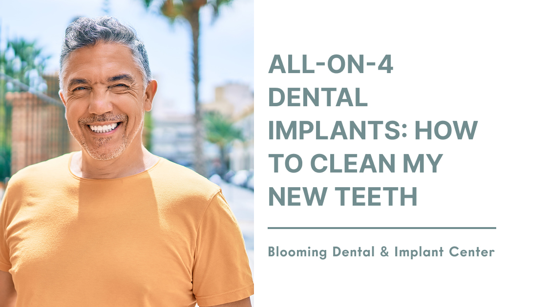 All-On-4 Dental Implants: How to Clean My New Teeth