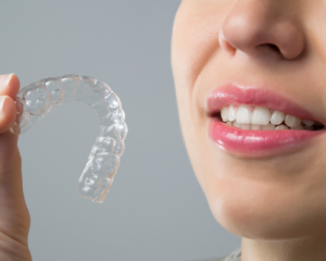 Invisalign