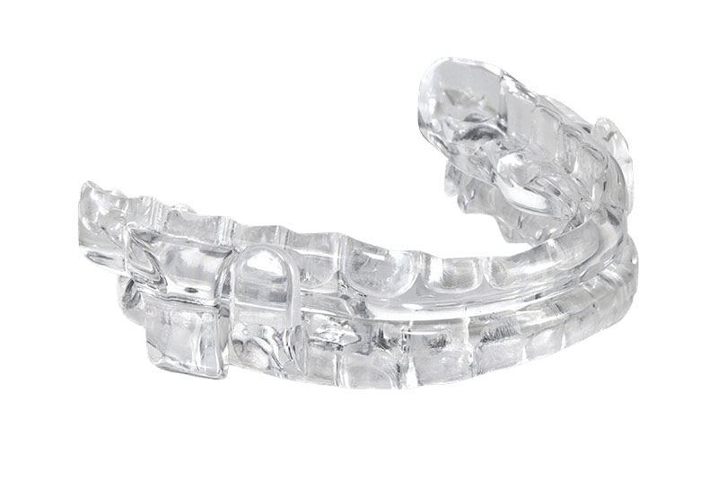 Oral Sleep Appliance gently holds your lower jaw forward