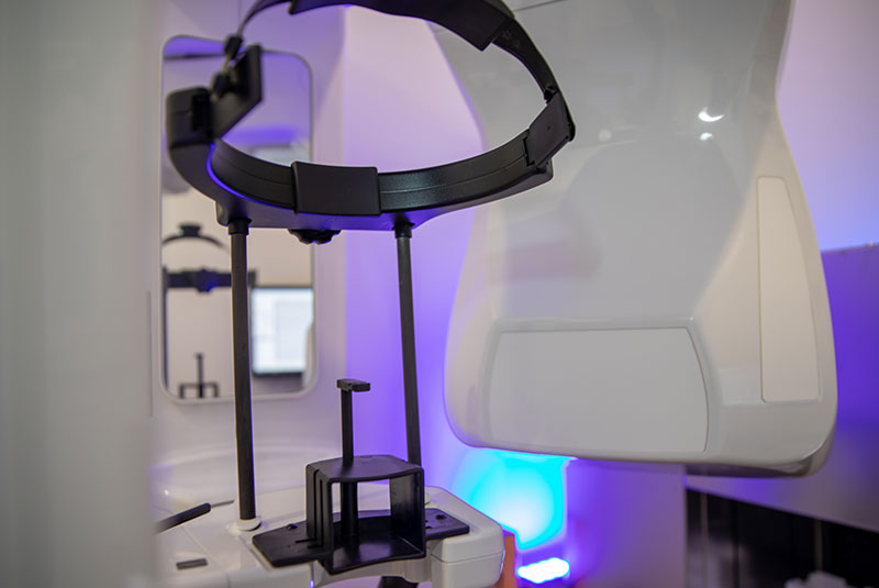 CBCT 3D Imaging