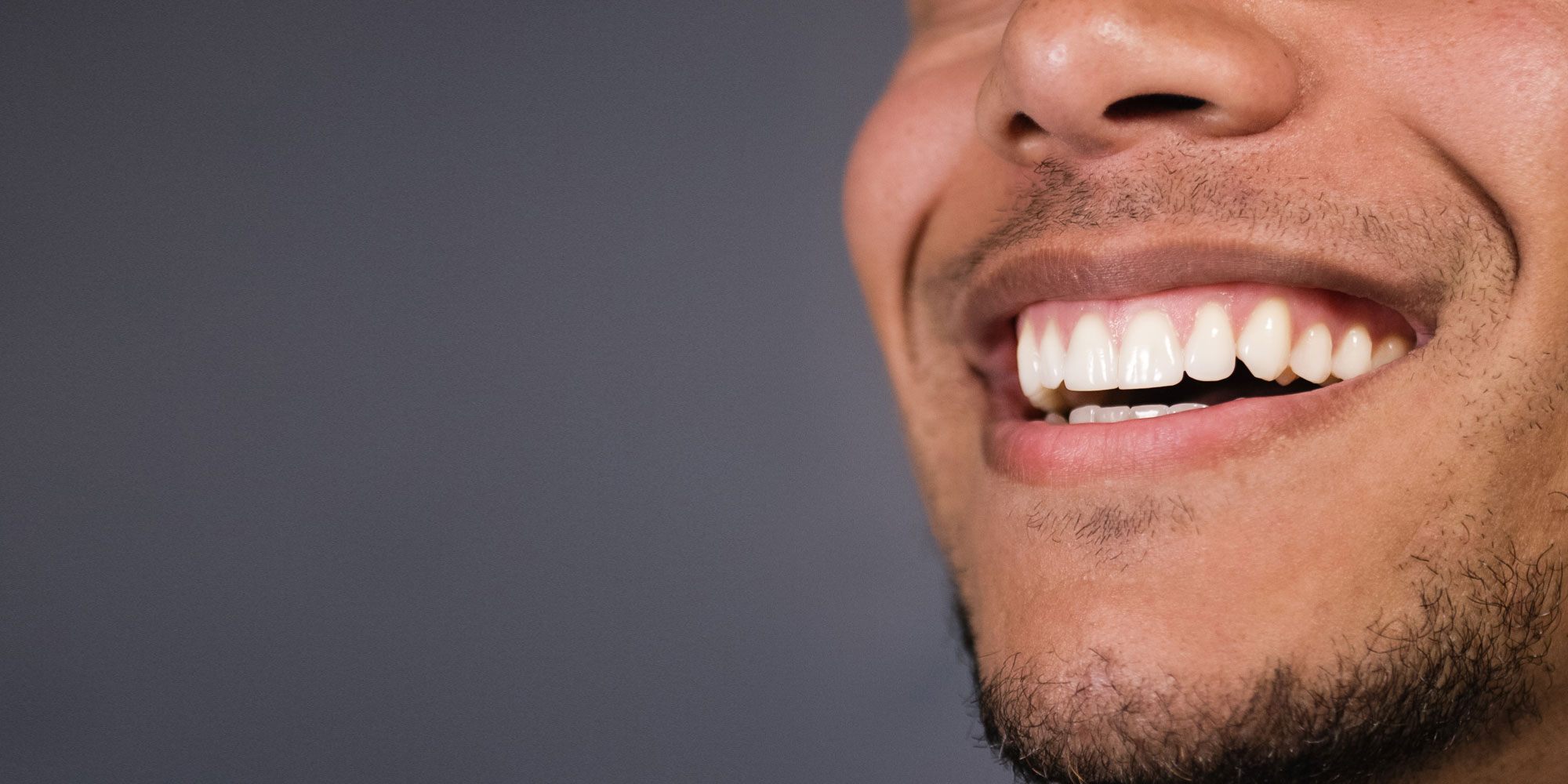Common Causes of Gummy Smiles