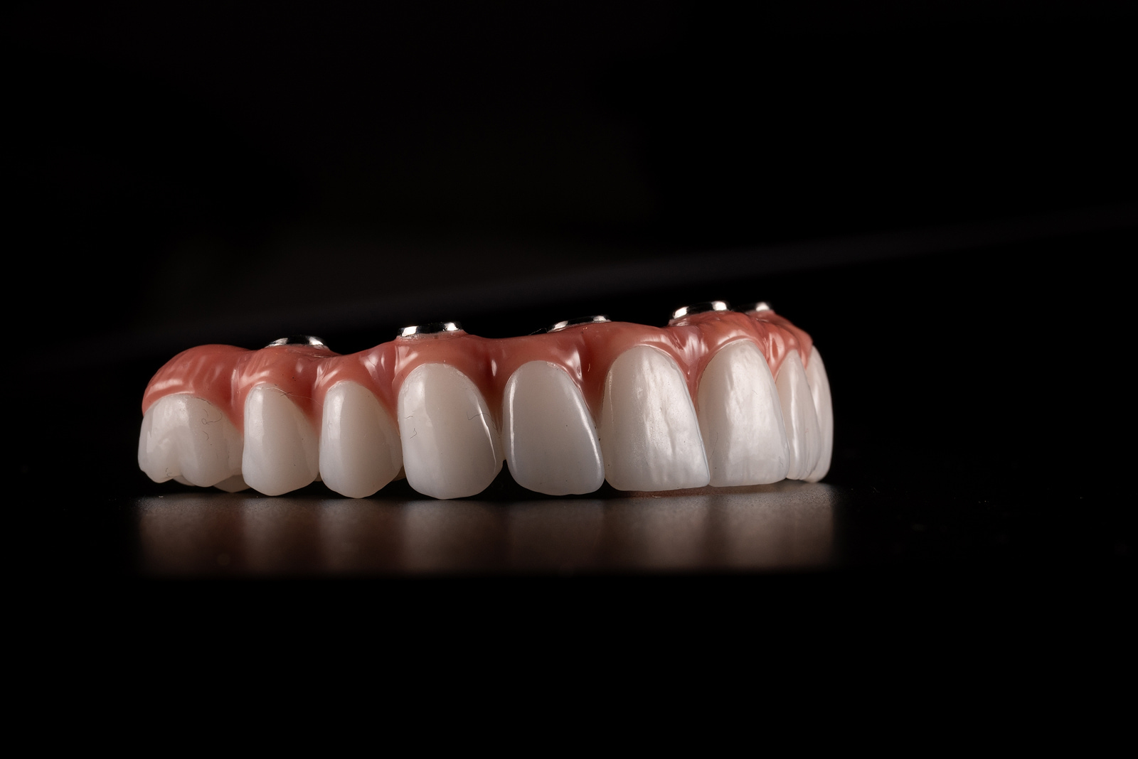 Full Arch Fixed Teeth