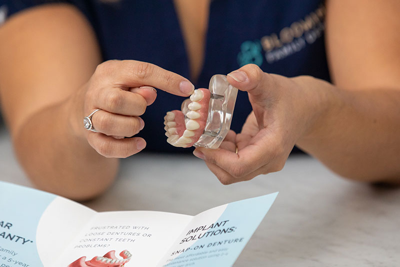 Dental Implants