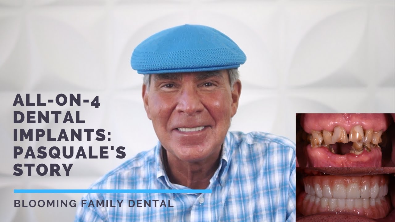 all on 4 dental patient