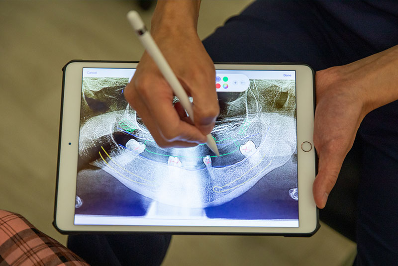 Dr. Chang Talks About Fixed Full Arch Vs Removable video