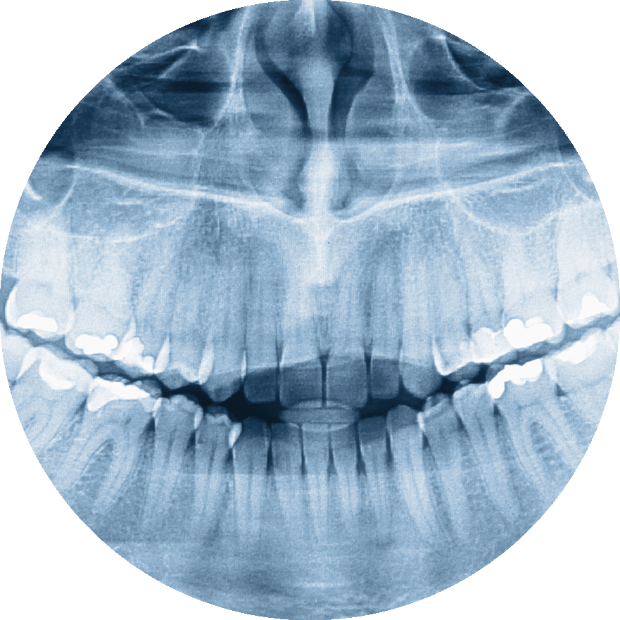 digital xray