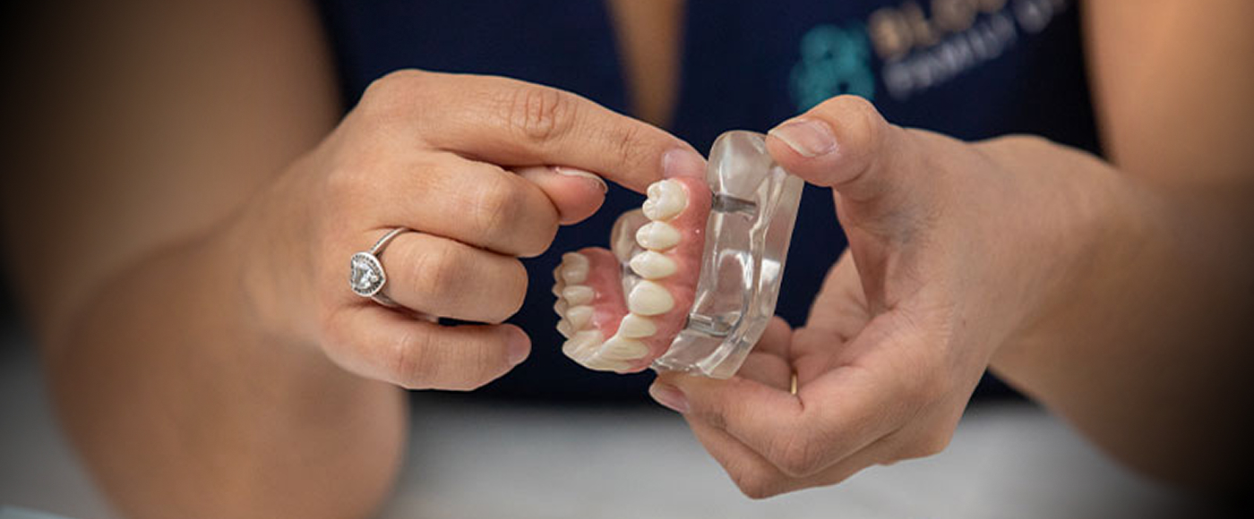 Dental Implant